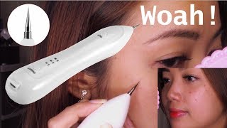 Warts and Mole Remover Pen EFFECTIVE or NOT [upl. by Ofori]