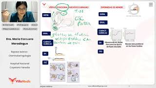 OTOLOGÍA PARTE 3  OTORRINOLARINGOLOGÍA  VILLAMEDIC [upl. by Hermine]