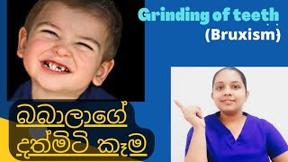 දරුවන්ගේ දත්මිටි කෑම  Teeth grinding of babies  Bruxism  Happy Family SL [upl. by Drabeck]