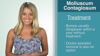 What Is  Molluscum Contagiosum [upl. by Roseanne]