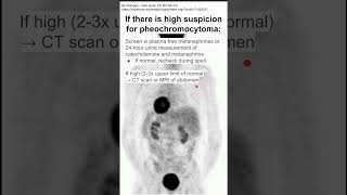 If there is high suspicion for pheochromocytoma [upl. by Buffo615]