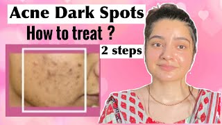 How to REMOVE DARK SPOTS from Face NATURALLY ACNE SPOTS [upl. by Arbba]