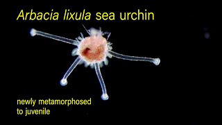 Arbacia lixula sea urchin newly metamorphosed to juvenile [upl. by Airetal]