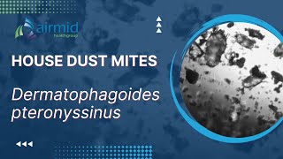 House Dust Mites  under the microscope at airmid healthgroup [upl. by Sadie]