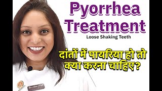 What is Pyorrhea How is Pyorrhea Treated दांतों में पायरिया payriya ka treatment [upl. by Tatia974]