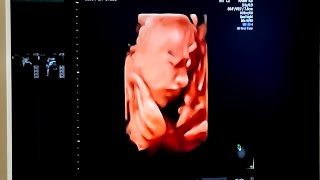 4D Ultrasound of my baby at 28 weeks baby pregnant 4dultrasound checkup eco [upl. by Analrahc]