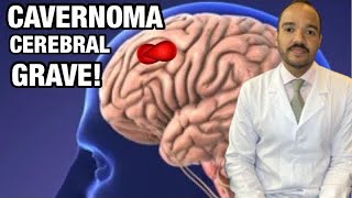 CAVERNOMA NO CÉREBRO 🧠 [upl. by Percival69]