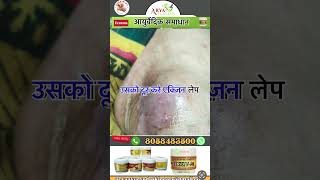 Eczema ayurvedic skin care [upl. by Haidadej]