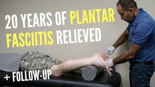 20 Years of Plantar Fasciitis RELIEVED With ASTR FOLLOWUP [upl. by Okkin290]