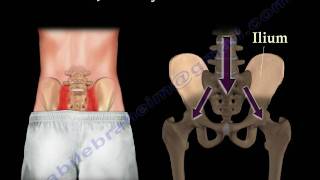 Sacroiliac Joint Dysfunction Animation  Everything You Need To Know  Dr Nabil Ebraheim MD [upl. by Ennasirk]