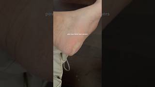 pov you waited too long for that pedicure 😬 pedicure callusremoval [upl. by Atela]