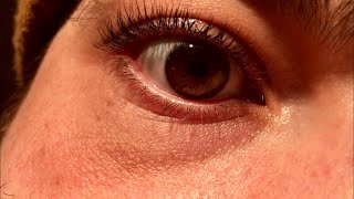 My eyelid twitching in slow motion [upl. by Nodaj]