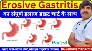 Erosive Gastritis Complete Diet Exercises and Treatmentdrramakantsharma7 [upl. by Adriana]