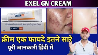 Exel gn cream use dose benefits and Side effects full review in hindi [upl. by Ettenad]