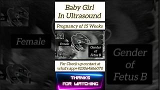 Baby Girl In Ultrasound  A Clear Clip  shorts [upl. by Leandro]