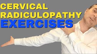 Best Cervical Radiculopathy Exercises  Exercises For Cervical Radiculopathy Dr Walter Salubro [upl. by Neirad]