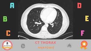 Anatomie in der Computertomographie CT des Thorax [upl. by Halland]