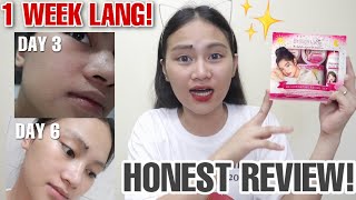 1 WEEK OF USING BRILLIANT SKIN REJUVENATING SET Philippines  Xy Castillo [upl. by Herman]