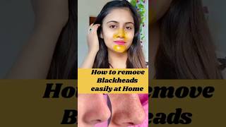 How to Remove Blackheads Easily🤫🥰shorts youtubeshorts viralshorts blackheads skincare foryou [upl. by Kaiulani]