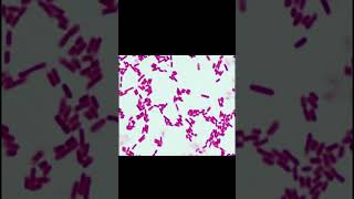 Gram negative bacilli microscopy staining microbiology gnb viral [upl. by Freddy]