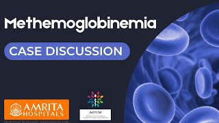 Methemoglobinemia  Case Discussion [upl. by Ydoj]