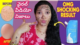 Salicylic Acid Mask in TeluguSalicylic Acid Ice Cream Mask Review in TeluguSalicylic acid icecream [upl. by Wilfrid]