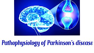 Pathophysiology Of Parkinsons Disease  Robbins pathophysiology  patholophysiology for doctors [upl. by Dot]