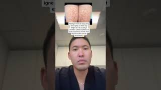 Dermatologist Texting Back on Erythema ab igne [upl. by Nomolos]