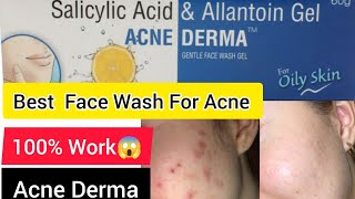 Salicylic Acid amp Allantoin Gel Acne Darma face Wash for acne pimpleBest Face Wash For Acne [upl. by Aniroz]