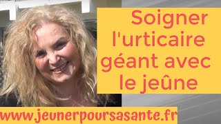 Comment Olga soigne son urticaire Géant avec le jeûne thérapeutique [upl. by Ahsiret570]