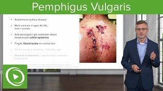 Pemphigus Vulgaris – Dermatology  Lecturio [upl. by Hunter]