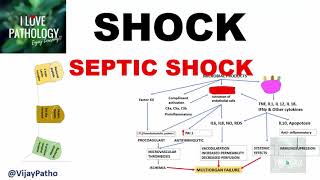 SHOCK Types Pathogenesis of Septic Shock [upl. by Hgieloj]