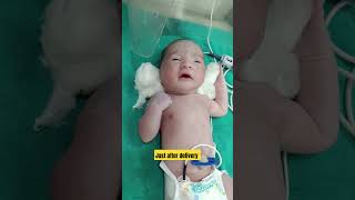 Newborn baby gruntingjust after delivery nicu icu baby cutebaby exercise cute [upl. by Nahn]