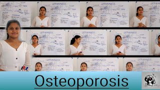 Osteoporosis Clinical Presentation Sinhala [upl. by Hanikas201]