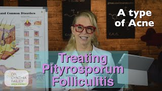 Treat Pityrosporum Folliculitis Dermatologists Tips 2019 [upl. by Mur]