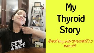 My Thyroid Story  මගේ තය්රොඉඩ් කතාව [upl. by Langsdon962]