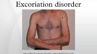 Excoriation disorder [upl. by Nnaeus]