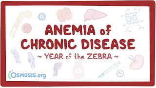 Anemia of chronic disease Year of the Zebra [upl. by Nnaaras]