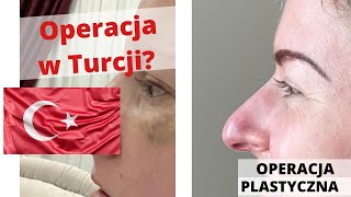 VLOG Operacja plastyczna nosa w Turcji  Eva w Turcji [upl. by Nawoj665]