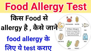 किस food से allergy है कैसे जाने  Food allergy test  Lactose  MSG  Gluten [upl. by Gladys]