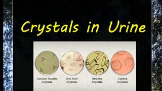 Urine Examination3 Crystals [upl. by Fates393]