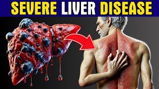 11 Strange Signs of LIVER DAMAGE Healthy Care [upl. by Farrington114]