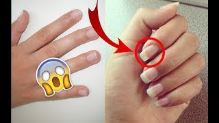 FAIRE POUSSER SES ONGLE 2× PLUS VITE  ÇA MARCHE [upl. by Norean368]