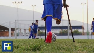 El fútbol no discrimina estos jugadores forman parte de un equipo de amputados en México [upl. by Hedveh]