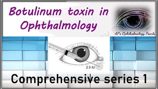 Botulinum toxin in Ophthalmology  Comprehensive series 1 [upl. by Celeski]