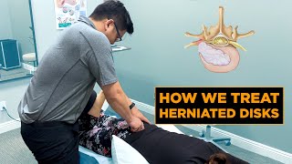 How We Treat a Herniated Disk  Physical Therapy [upl. by Sharleen633]