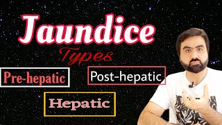 Jaundice  Types of Jaundice  Prehepatic  Hepatic  Posthepatic  UrduHindi [upl. by Nottap]