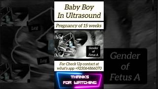 Baby Boy In Ultrasound  A Clear Video  shorts [upl. by Joacimah690]