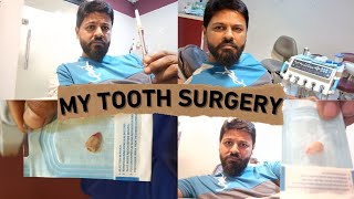 wisdom teeth removal surgery extraction in under one minute surprise [upl. by Hamaso]