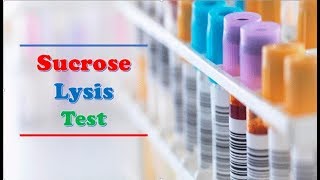 Hematology 🔤  🔹🔹 Sucrose Lysis Test 🔸🔸 [upl. by Kablesh]